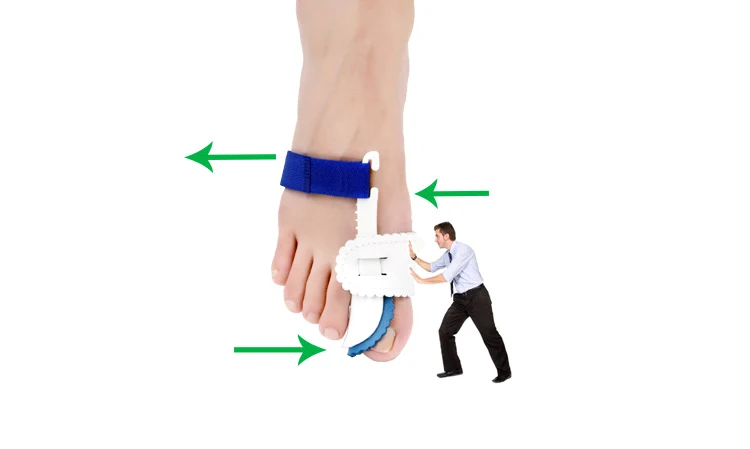 

Foot Spacers, Toe Orthosis Support Brace Corrector, Bunion Repair Tool, Hallux Valgus, 1 pair