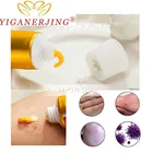 10 шт., травяной крем от псориаза YIGANERJING, 15 г