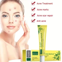 effective acne cream acne treatment cream acne removal fade acne spots oil control shrink pores whitening moisturizing skin care