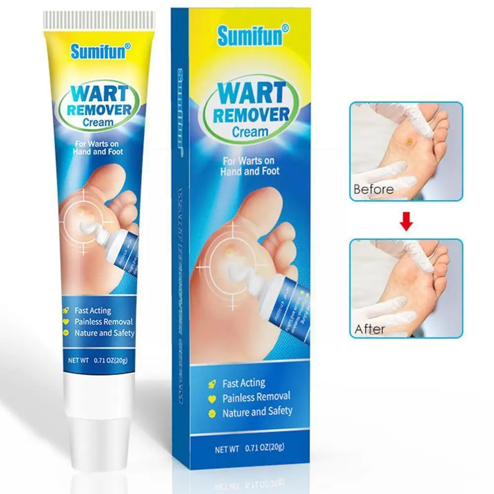 

Мазь для удаления бородавок, крем для лечения бородавок, кожи шеи, бородавок, антибактериальная плоская бирка, бородавок, гениталий, мазь дл...