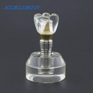 1 шт., стоматологическая акриловая модель зубного импланта, модель зубного импланта #2020, Обучающие модели стоматологии