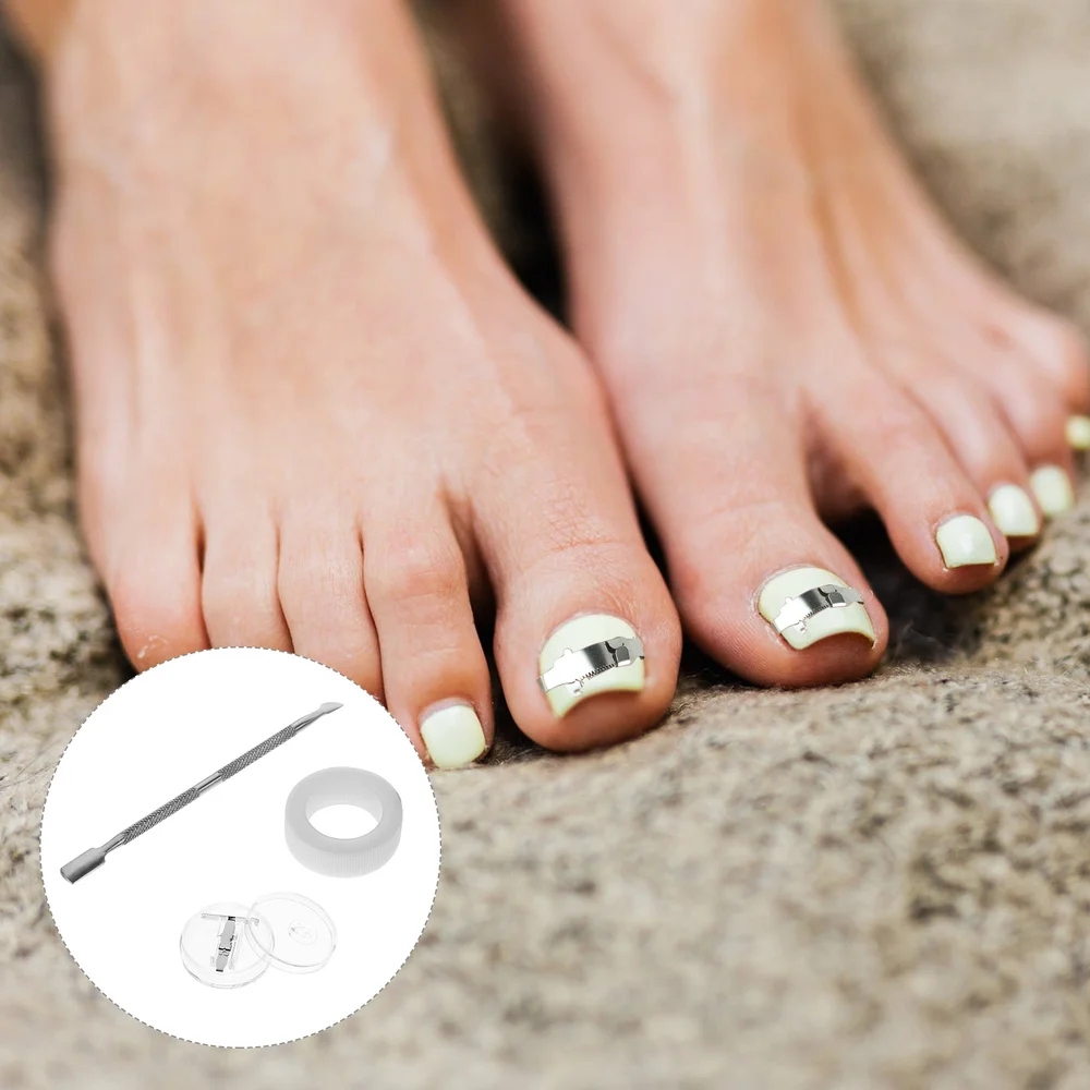 

1 Set Stainless Steel Toenails Correction Buckles Nail Straightening Clip Tools