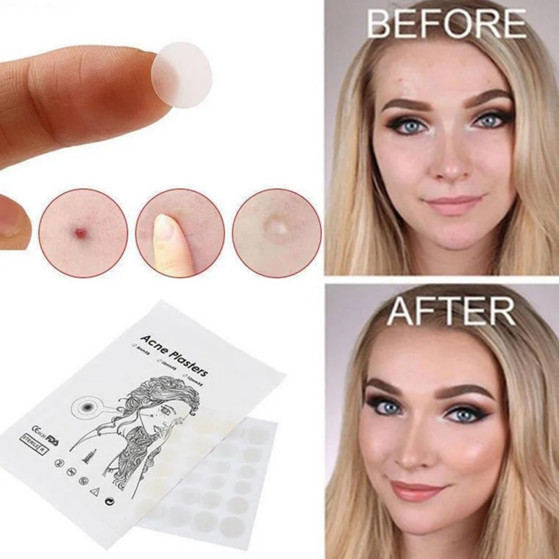 Unisex Acne Pimple Patch Invisible Stickers Skin Bead Master Patch Skin Sticker Patch Pimple Spot Acne Remover