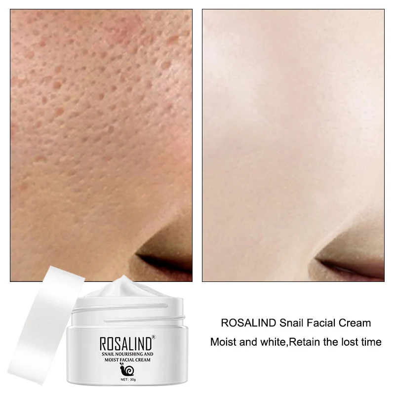 Улиточный крем увлажняет восполняет чистый анти чувствительный QRD88| |