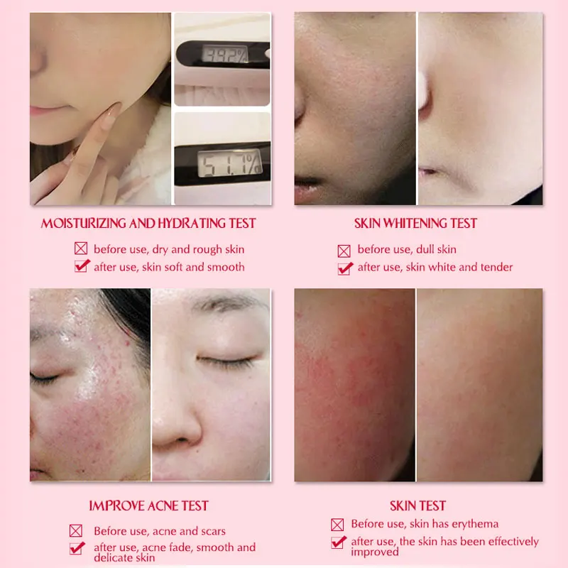 Отбеливающая увлажняющая сыворотка ARTISCARE 100% с экстрактом улитки для ухода за