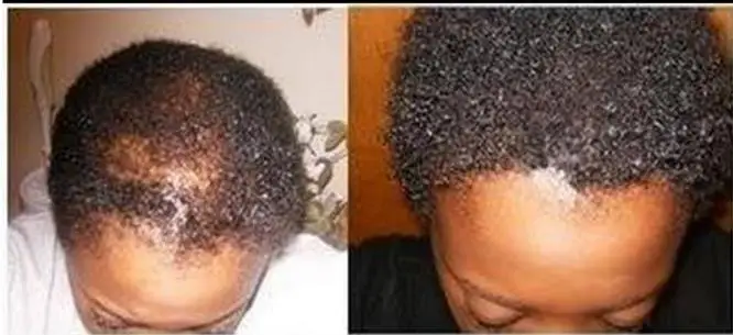 Масло черного касторового масла для роста волос и ресниц/4zo X 1 бутылочка | Красота