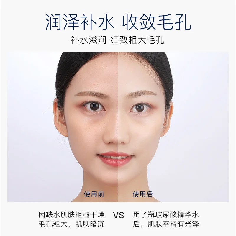 

Image beauty nicotinamide essence water shrink pores, moisturize skin, nourish skin, moisturize skin and moisturize skin.