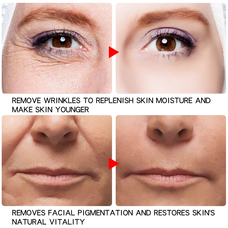 Крем для риса гиалуроновая отбеливающая увлажняющая питательная против морщин