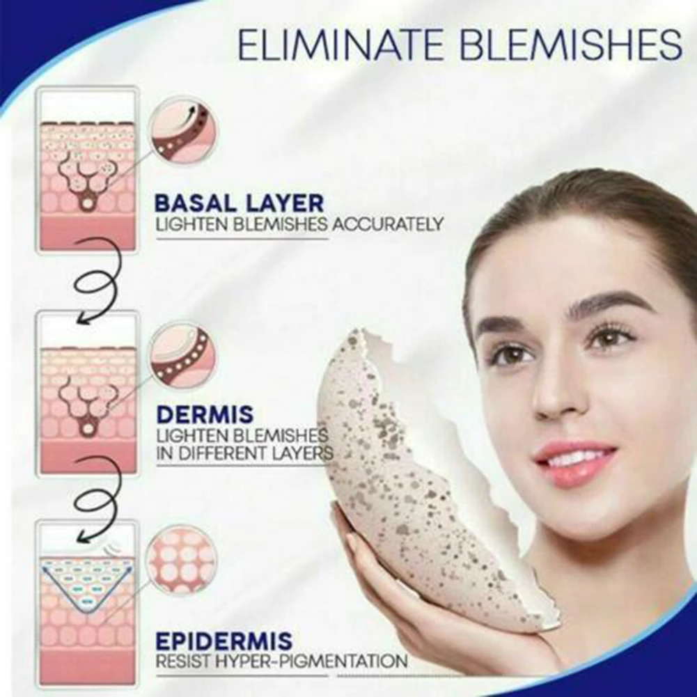 

Skin Cream Anti Acne Scar Blemish Stretch Marks Freckle Removal Face Cream J9