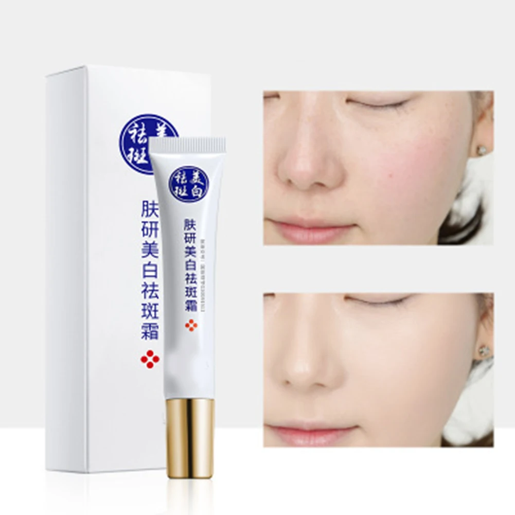 

Skin Cream Anti Acne Scar Blemish Stretch Marks Freckle Removal Face Cream MH88