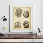 Медицинский постер с принтом головы человека, анатомия, винтажная иллюстрация, неврология, искусство, холст, картина, подарок для Кабинета