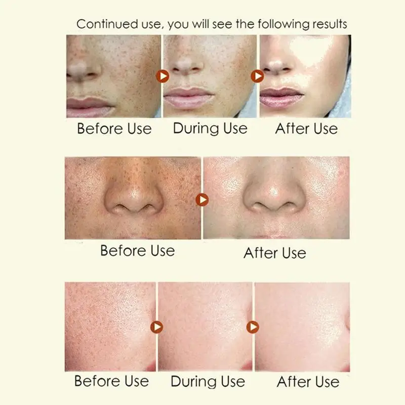 2.5% ретинол увлажнитель для лица крем витамин а с Гиалуроновая кислота зеленый