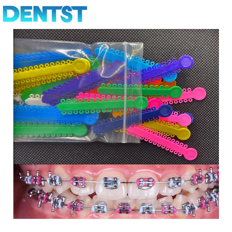 

Dentst 1040 Pcs Dental Elastomeric Ligature Ties Orthodontics Elastic Rubber Bands Braces for Brackets Ortodoncia