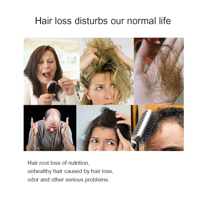 Кондиционер для роста волос маска ухода за волосами утолщение против выпадения