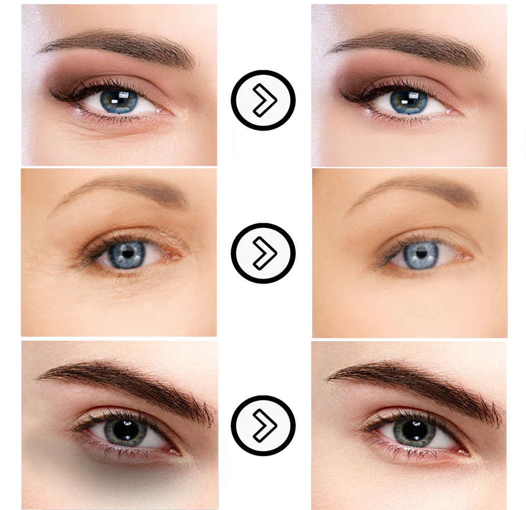 10 шт. крем для кожи вокруг глаз от морщин и тёмных кругов |