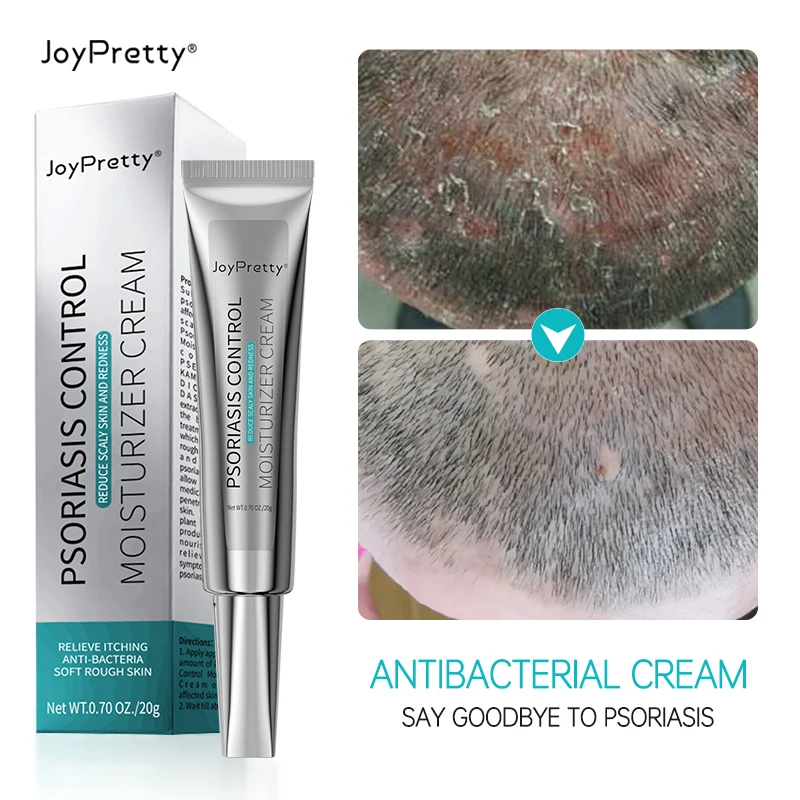 

JoyPretty Herbal Antibacterial Gel Psoriasis Cream Ointment Anti-itch Relief Eczema Skin Rash Urticaria Desquamation Treatment