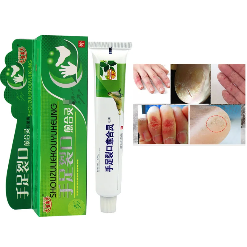 

Chilblain Cream, Chapped Skin Care Cream, Hand and Foot Crack Healing Cream, Moisturizing and Hydrating Hand Cream Moisturizer