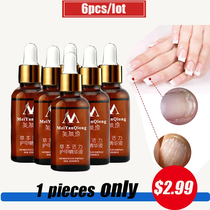 6 шт. грибковый гель для лечения Ногтей эссенция и отбеливающий грибок ног