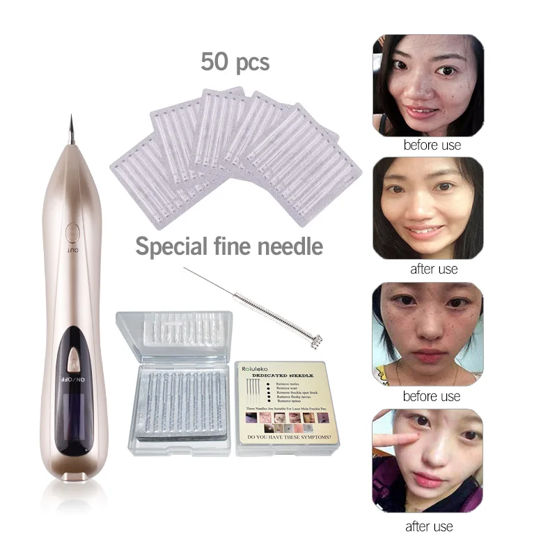 Новейшая плазменная ручка лазерная татуировка кожи машина для удаления темных