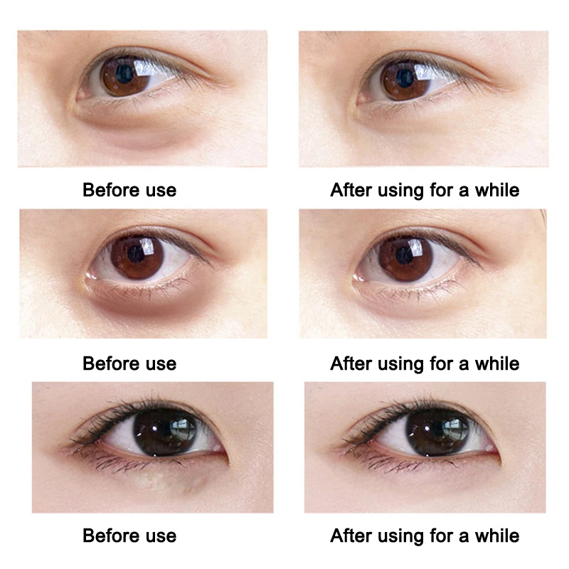 Miracle Age Defying Eye Cream Lifting Firming Diminishing Fine Lines And Dark Circles For Women TEEA889 | Красота и здоровье