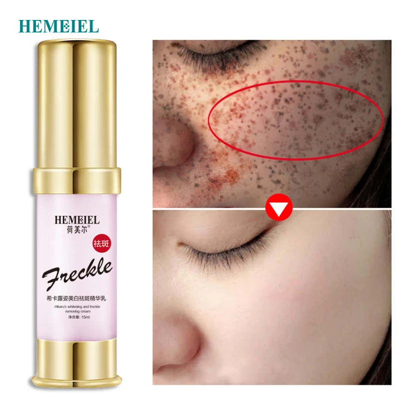 HEMEIEL сильно отбеливающий крем для лица от черных точек корректор удаления