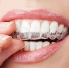 Новая горячая Распродажа термоформования для видеосъемки зубастого рта стоматологический лоток для отбеливания зубов, гвардии отбеливания зубов