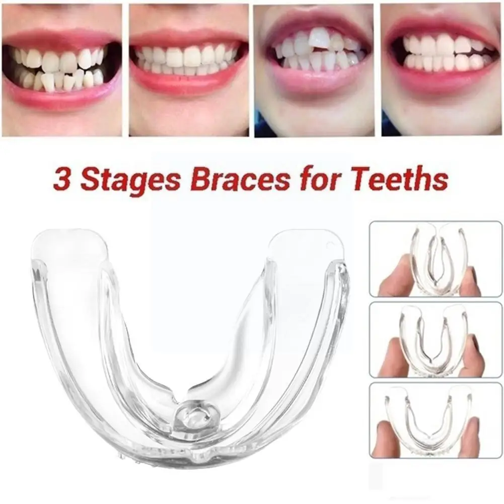

Ортодонтические зубные скобы, зубные скобы, поднос для выравнивания зубов, тренажер, фиксатор зубов, Силиконовые Зубные скобы, зубной рот Gu ...