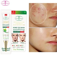 3 days acne treatment face cream effective anti acne fade acne oil control whitening moisturizer shrink pores face gel skin care