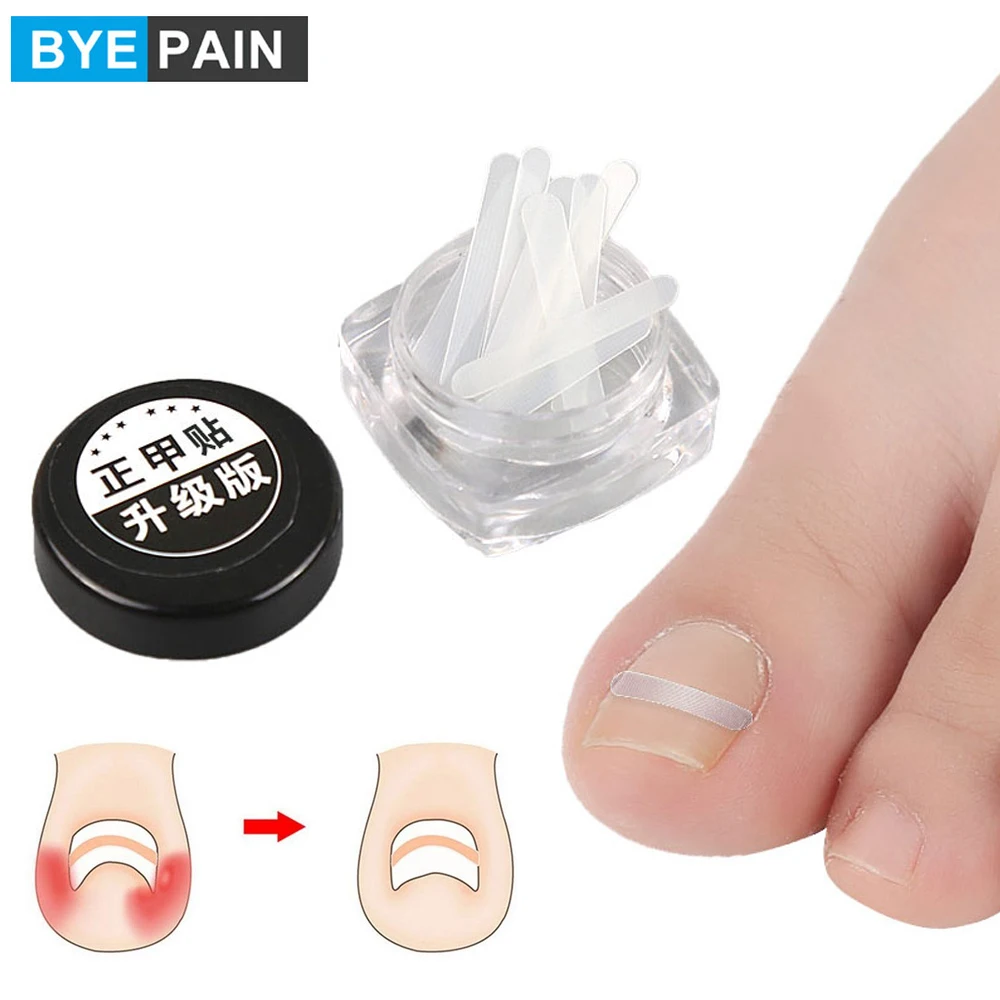 10 шт./компл. BYEPAIN ToeNail Art коррекция вросших наклеек фиксатор Paronychia
