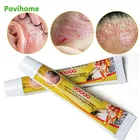 Бальзам тигровый от экземы крем от псориаза, антибактериальный дерматит, зуд, экзематоидная травяная мазь, 123 шт.