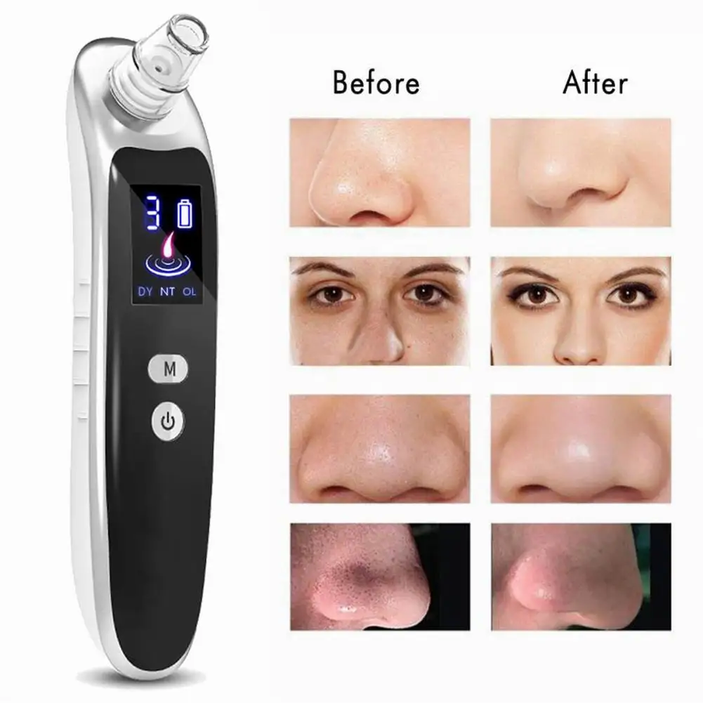 

Electric Blackhead Remover Pore Skin Care Tools Blackhead Acne Vacuum Cleaner Nose Face Deep Cleansing Suction Machine