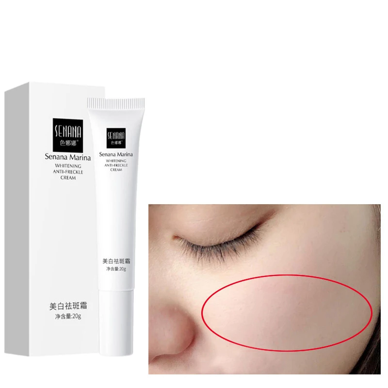 

Импортный никотинамид, веснушки, отбеливающий крем для лица, против морщин, удаление пятен, укрепляющий темные круги, уход за кожей