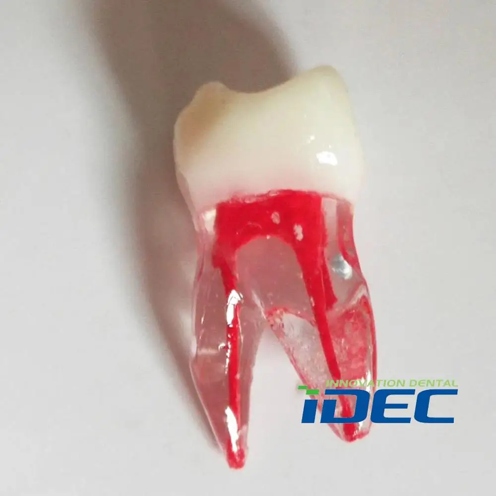 

Teeth model 1:1 Resin Dental Endodontic Student Study Practice Operation Model Colored Root Canal 6PCS