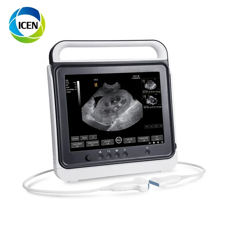 

IN-A50A portable Ultrasound machine price Ultrasound scanner