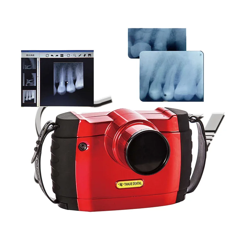

Factory supply tooth x-ray tooth portable camera X-ray for tooth clinic