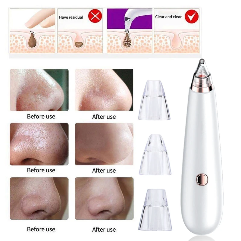 

Electric Acne Remover Blackhead Vacuum Point Noir Extractor pore cleaner Pimple Removal Suction Machine face T Zone Beauty Too