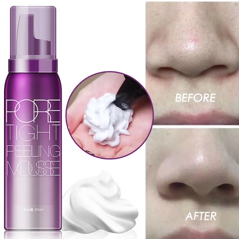 

Exfoliating Neutralizing Foam Stayve 80ml BB Cream Glow Starter Must-have Kit DermaWhite Clean Pores Remove Blackheads Face Foam