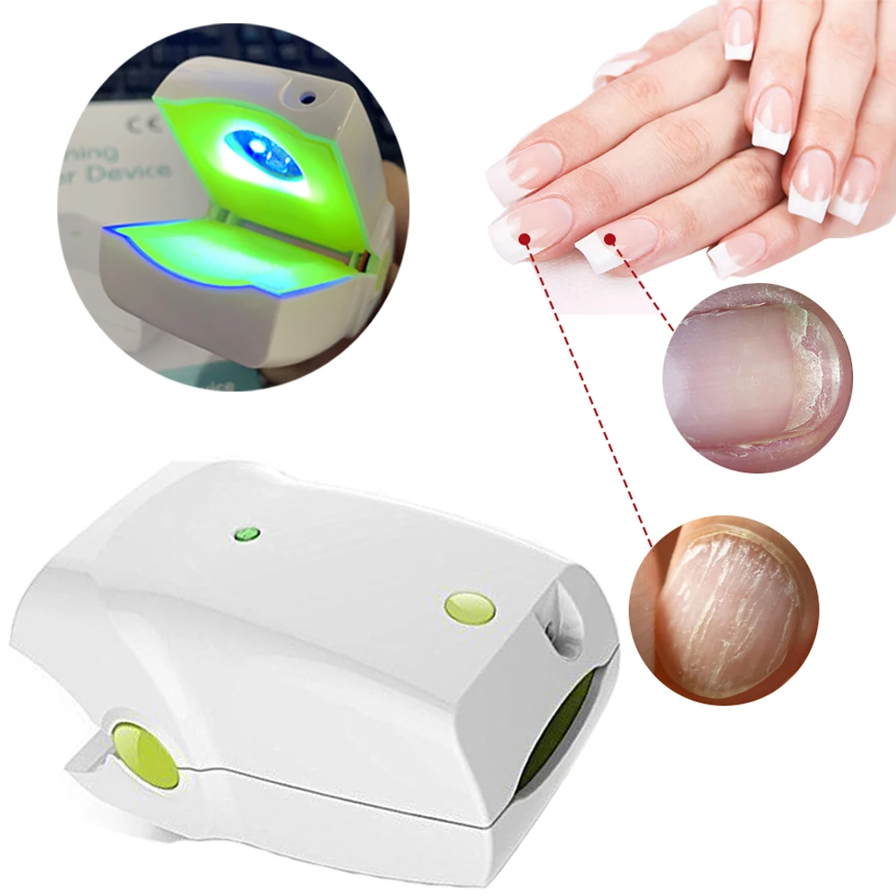 NEW Home Use Cure Ex ToeNail Fungus Removal Onychomycosis Paronychia Infection Anti Fingernail Fungal Fungus Infection