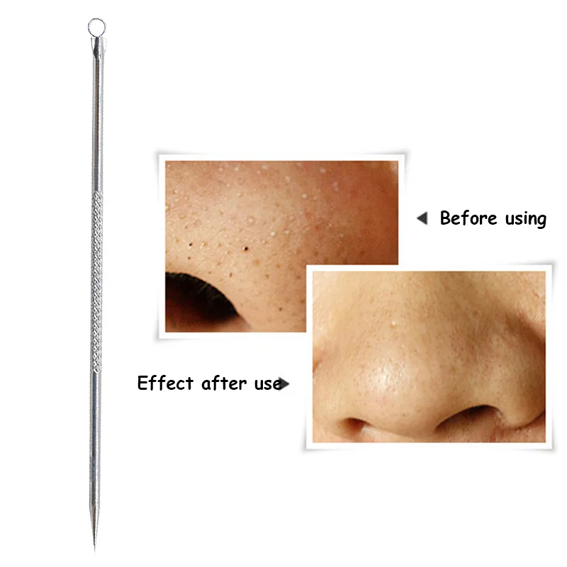 Инструмент для удаления черных точек игла чёрных прыщей пор| |