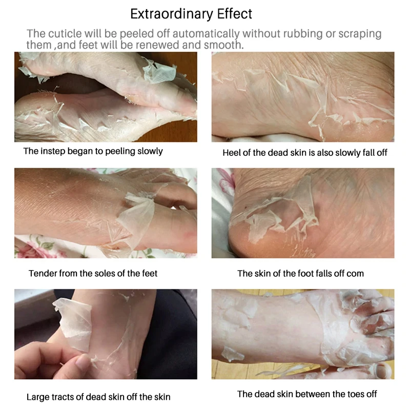 

1pair Feet Mask Exfoliating Dead Skin Foot Mask Exfoliating Mask Foot Care Socks For Pedicure Spa Hot Selling