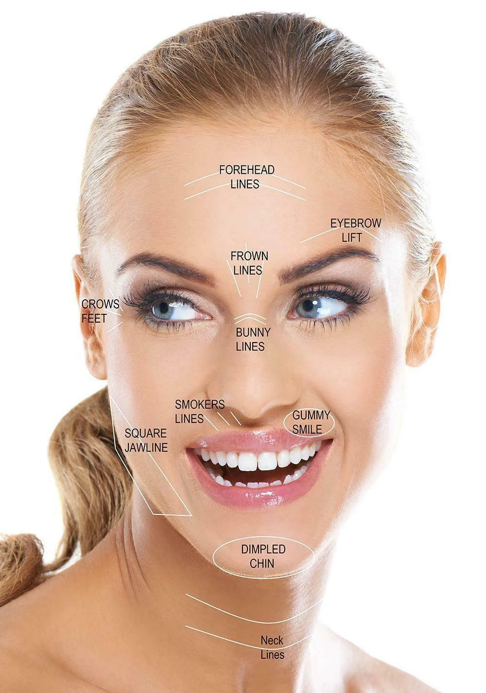 

Aesthetics Botox Treatment Areas Advertising picture Art Film Print Silk Poster Home Wall Decor 24x36inch