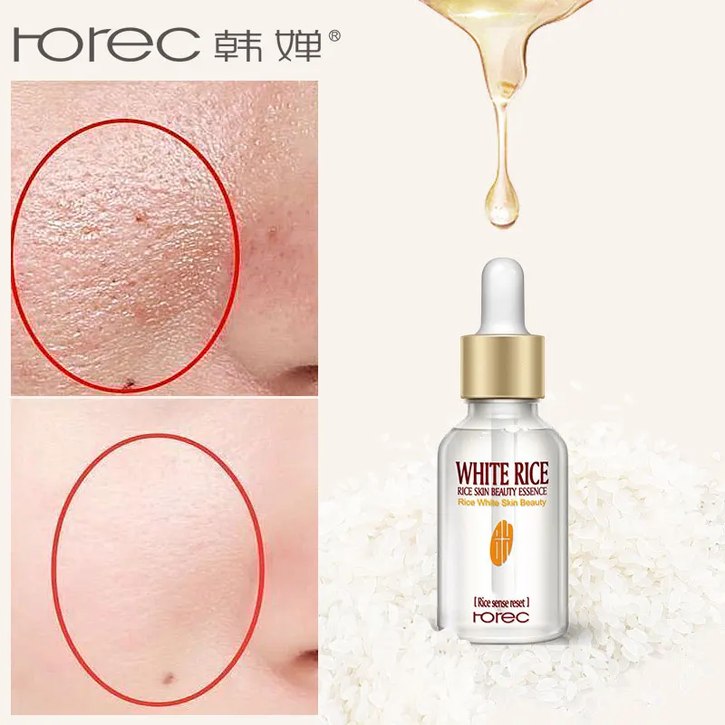 Сыворотка для лица ROREC Pure Rice отбеливающая увлажняющая лечения акне