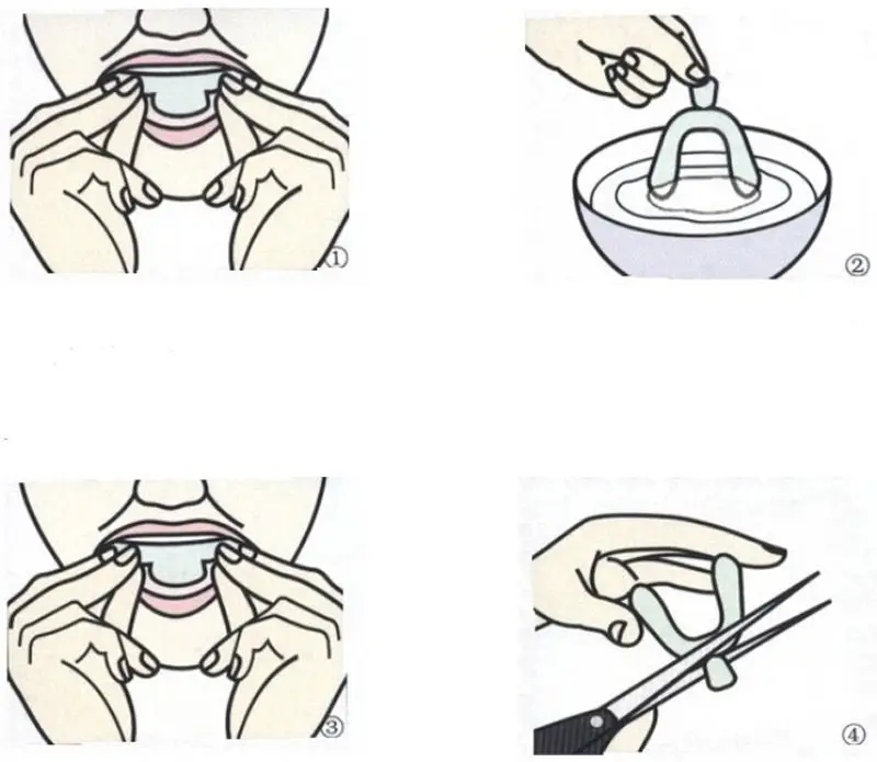 Термоформования для видеосъемки зубастого рта из лотки отбеливания зубов