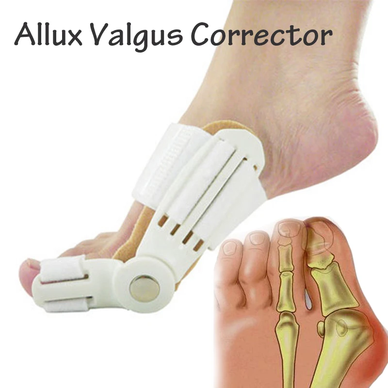 

1 пара = 2 шт., ортопедический корректор вальгусной деформации