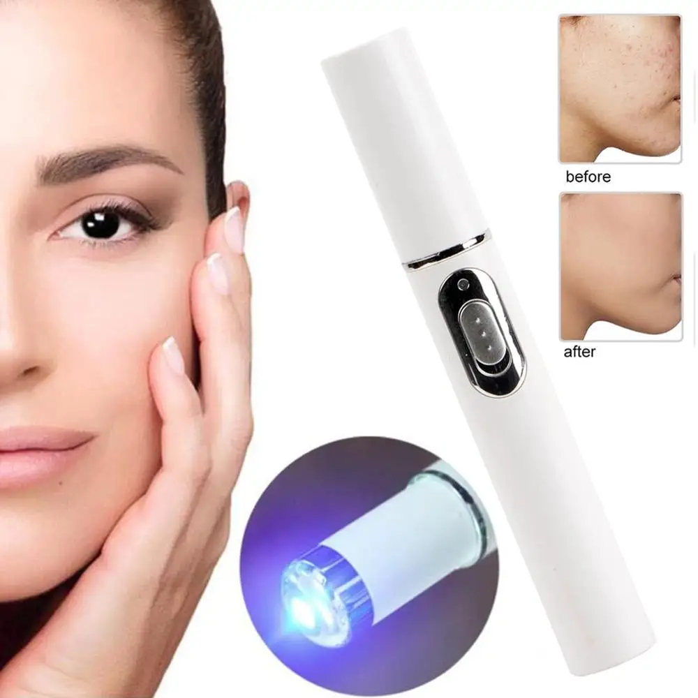 Акне лазерная ручка удаление морщин машина Портативный прочный синий светильник