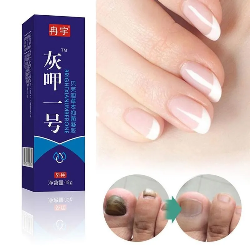

Nail Fungal Treatment Cream Feet Care Nail Foot Whitening Toe Nail Fungus Removal Cream Anti Infection Paronychia Onychomycosis