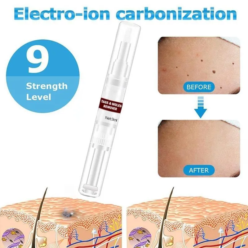 

3ml wart corn remove Tags & Moles Remover Wart Removal Pen Wart Genital Treatment