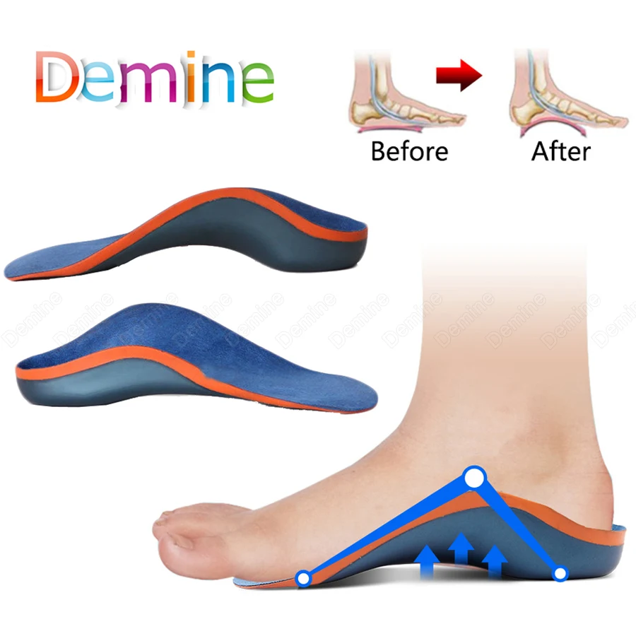 

Demine Children's Orthopedic Shoes Sole Insoles for Kids X/O Type Leg Flat Foot Arch Support Pad Shoe Inserts Orthotic Insoles