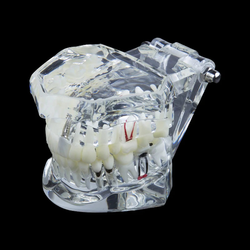 Стоматологическое лабораторное оборудование стоматологическая анатомическая