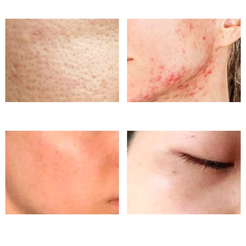 

Glycolic Acid 7% Ordinary Sensitive skin Toning Solution Brighten Moisturizng Smoothing tone improve skin texture Care Cosmetics